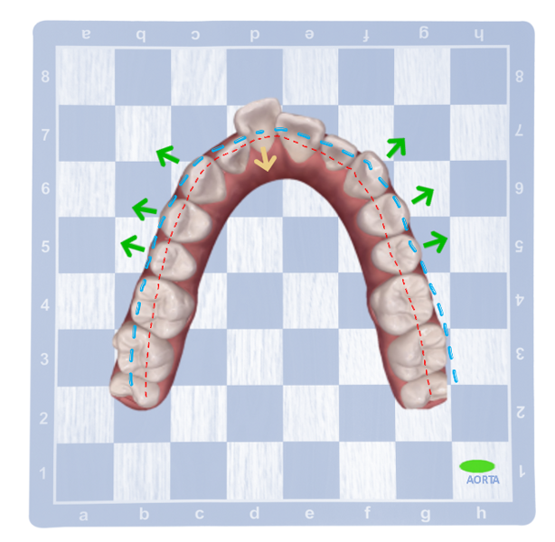 Fig. 20: Using AORTA’s simple, advanced, complex protocols to demonstrate the treatment goals.