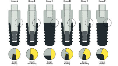 Canine study finds implant-abutment interface configuration may influence crestal bone changes Canine study finds implant-abutment interface configuration may influence crestal bone changes