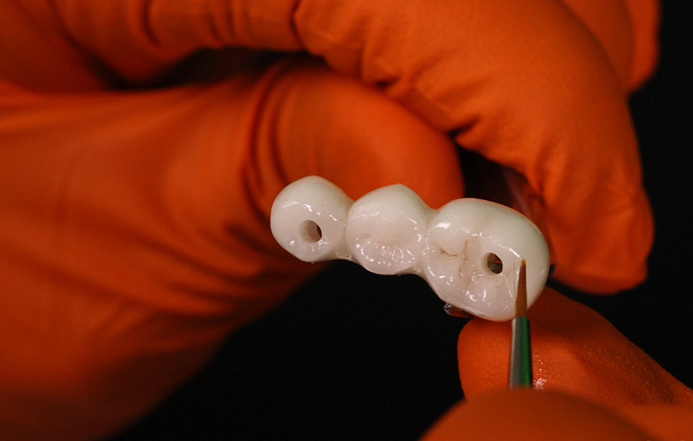 Fig. 5: Characterisation of 3D-printed implant restoration using a stain and glaze system.