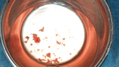 Biomateriales naturales Biomateriales naturales