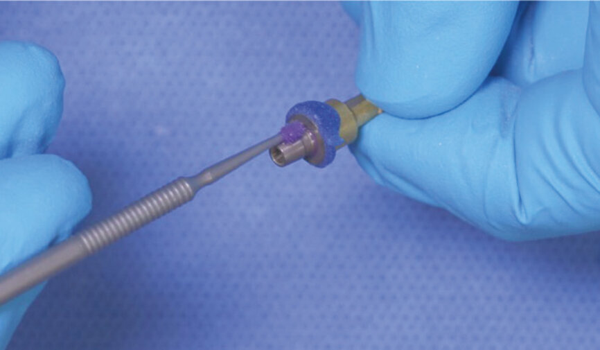 Fig. 4: Clean the abutment with KATANA Cleaner by rubbing for 10 seconds and then rinse and dry the abutment. 