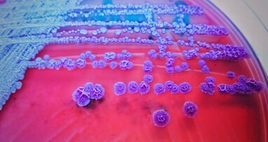 New summary of antimicrobial prescription guidelines available