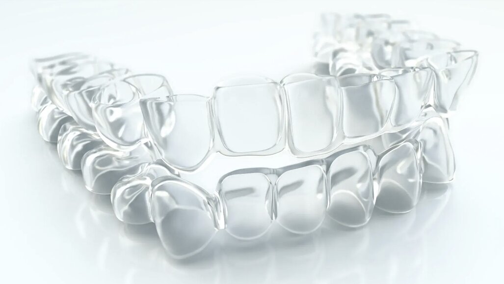 Planmeca пуска на пазара нова система прозрачни алайнери HeySmile