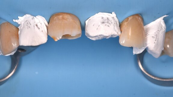 Het Dahl-concept: praktische inzichten gebaseerd op vijf jaar follow-up