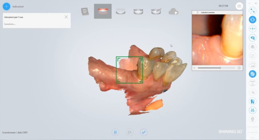 Figg. 7, 8_Arco inferiore.