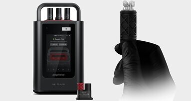 Single-appointment 3D printing of inlays and onlays with Midas