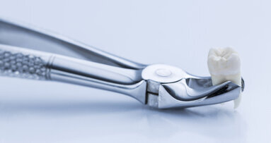 Scientists link childhood trauma to tooth loss later in life