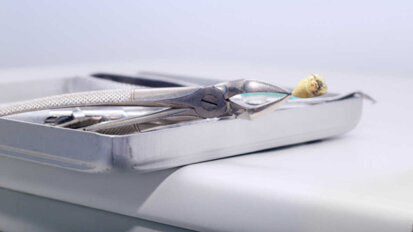 Instalações odontológicas estimuladas a usar separador de amálgama