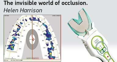 The invisible world of occlusion