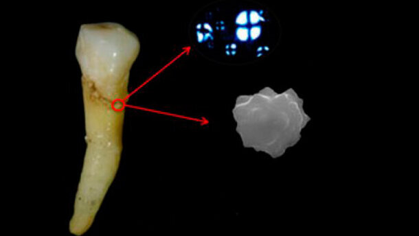 Isola di Pasqua: una placca dentale fa scoprire l’utilizzo di una pianta fondamentale nella dieta preistorica
