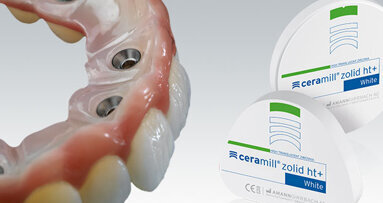 Ceramill Zolid HT+ – perfekcyjna symbioza estetyki i wytrzymałości