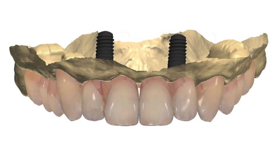Fig. 35_Sovrapposizione di un’immagine stilizzata degli elementi realizzabili con un margine muso ricreato.