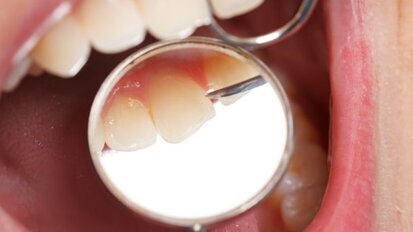 NZa onderzoekt ‘foutieve declaraties’