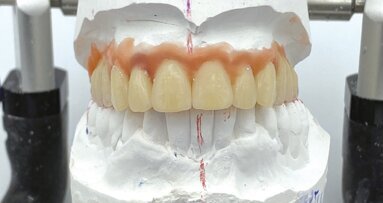 Toronto a carico immediato: un nuovo modo di interpretare vecchi concetti ottenendo il massimo da ognuno di essi