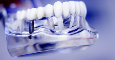 The transparent gingiva project IV