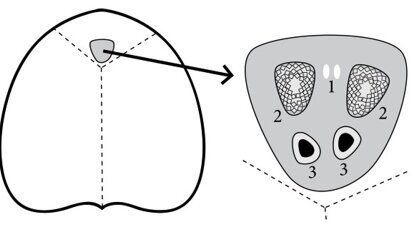 Otwarty przewód nosowo-podniebienny jako przyczyna dolegliwości w przednim odcinku szczęki – przegląd piśmiennictwa