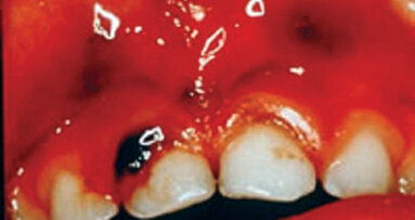 Identifying and responding to the drug-endangered child