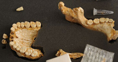 Zahnstein enthüllt: Schon Neandertaler nutzten Heilpflanzen