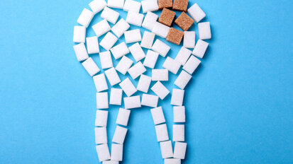 Study suggests sugar consumption and early interruption of breastfeeding are risk factors for dental caries in infancy