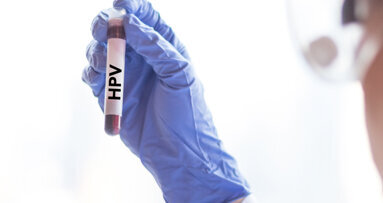 Cancer drug may help treat human papillomavirus infections, study finds