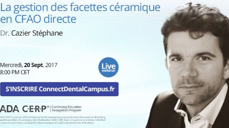 Webinaire : La gestion des facettes céramique en CFAO directe ».