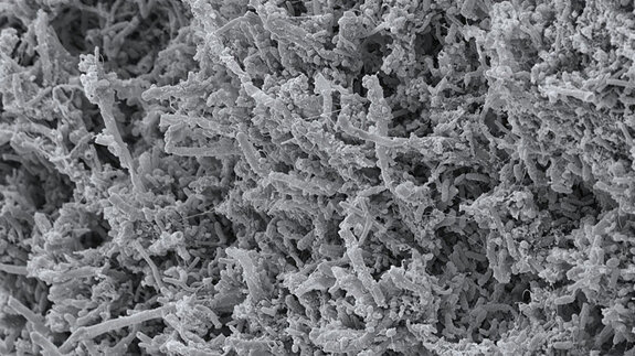 Projekt „MinOroBiome“ untersucht bakterielle Biofilme im Mund