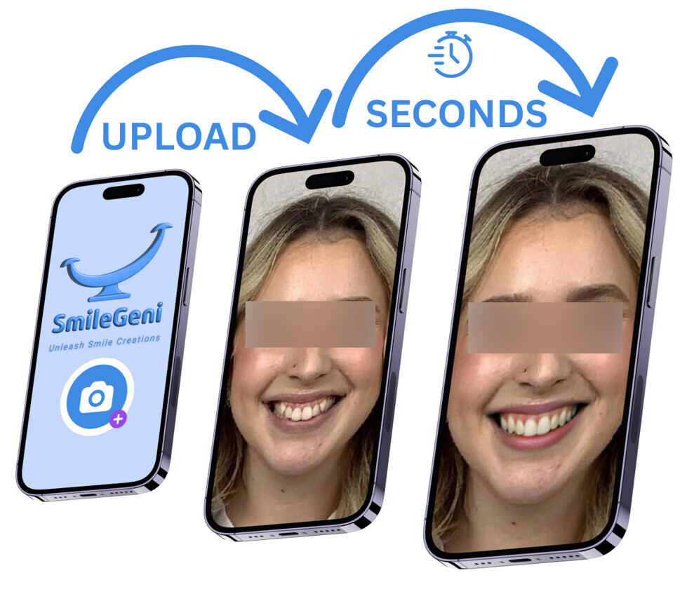 Fig. 7: Before and after, case version 2.