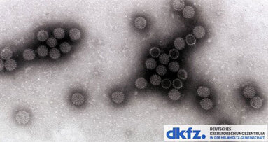 Biomarker für virusbedingten Krebs im Rachenraum gefunden