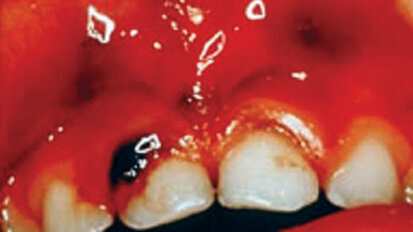 Identifying and responding to the drug-endangered child Identifying and responding to the drug-endangered child