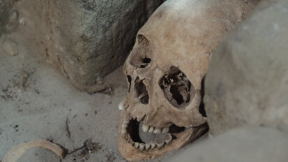 Zivilisationskrankheit Karies gab es bereits vor 12,5 Mio. Jahren Zivilisationskrankheit Karies gab es bereits vor 12,5 Mio. Jahren