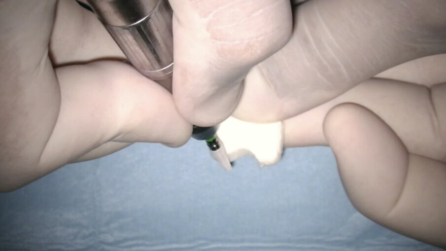 Fig. 20_Personalizzazione della matrice collagene.