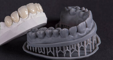 Digital fuel—what is propelling the markets for 3D printers and other CAD/CAM devices?