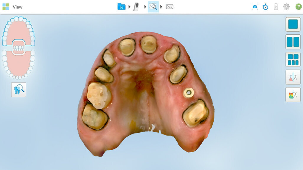 A game-changer in digital restorative dentistry