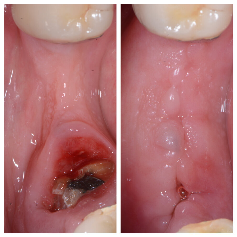 Fig. 1b_Cambiamento dei tessuti a 22 giorni.