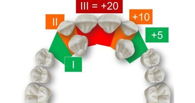 Protocolo para el pronóstico de los caninos superiores retenidos