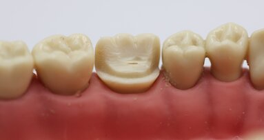 Blended dentistry: A workflow for merging conventional pinlay fundamentals with emerging technologies