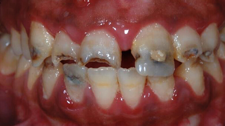 Estética dental y comunicación con el paciente