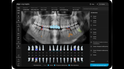 Align Technology introduces new software innovations designed to accelerate digital practice transformation