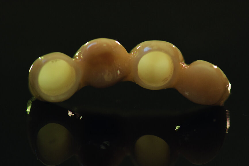 Fig. 41: The zirconia bridge without any ceramic veneer.