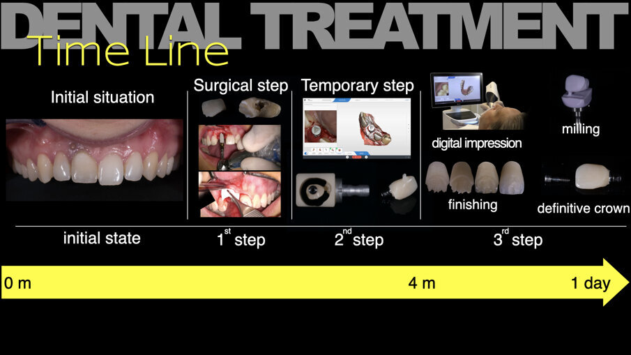 Fig. 8_Piano di trattamento definitivo.