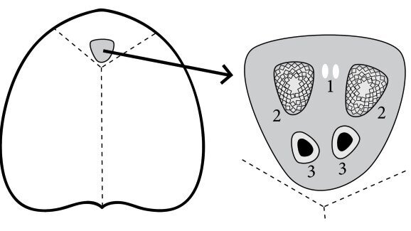 Otwarty przewód nosowo-podniebienny jako przyczyna dolegliwości w przednim odcinku szczęki – przegląd piśmiennictwa