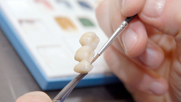 Beste Prothetik-Dissertation gesucht