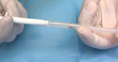 Prise en charge non chirurgicale de la péri-implantite par un traitement mécanique, antiseptique e