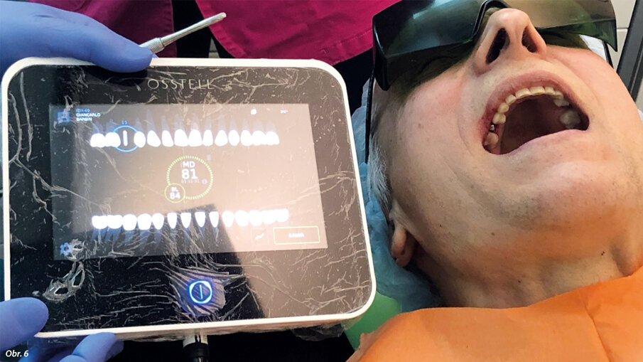 Určování hodnoty ISQ