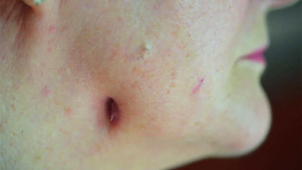 “Find it, fix it, and leave it alone”