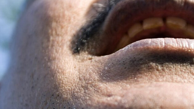 Dentists may be facing bigger in Pakistan in war against oral cancer