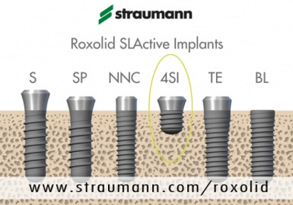 Meer mogelijkheden met het nieuwe Roxolid SLActive-portfolio