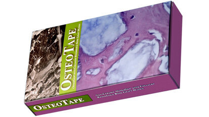 Impladent Ltd. announces breakthrough in innovative preformed porous bone graft technology