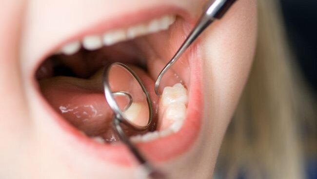 Nederlander vaker naar tandarts