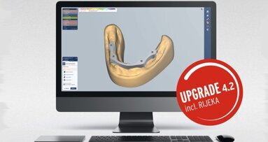 El mecanizado de restauraciones llega a un nuevo nivel